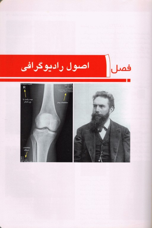 تفسیر رادیوگرافی اندام و ستون فقرات در اورژانس