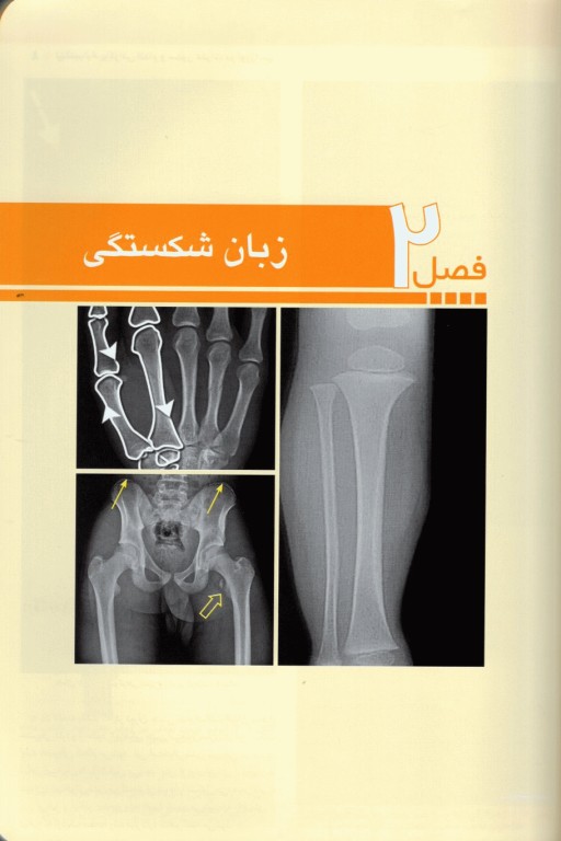 تفسیر رادیوگرافی اندام و ستون فقرات در اورژانس