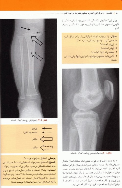 تفسیر رادیوگرافی اندام و ستون فقرات در اورژانس