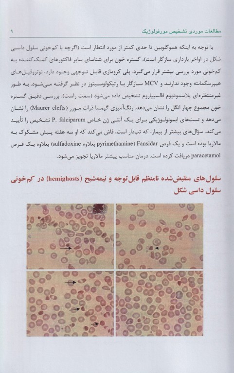 خونشناسی مطالعات موردی تشخیص مورفولوژیک