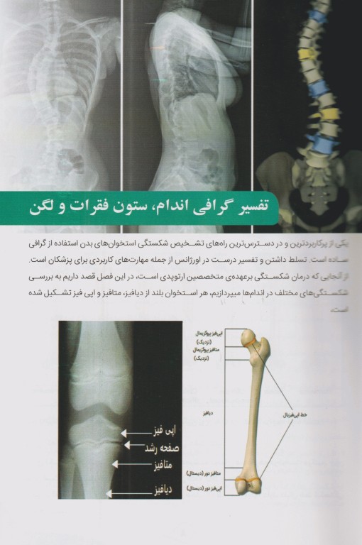 آموزش پایه تا پیشرفته تفسیر انواع رادیوگرافی در اورژانس دکتر جواد قربانی