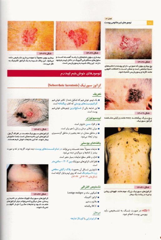 آسان آموز پزشکی abc medicine درس آزمون بیماری‌های پوست و مو