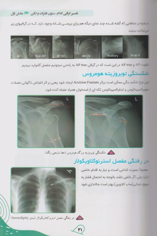 آموزش پایه تا پیشرفته تفسیر انواع رادیوگرافی در اورژانس دکتر جواد قربانی