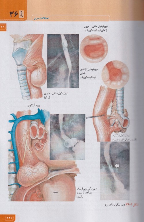 مبانی طب داخلی سسیل 2022 بیماری‌های گوارش کبد و مجاری صفراوی