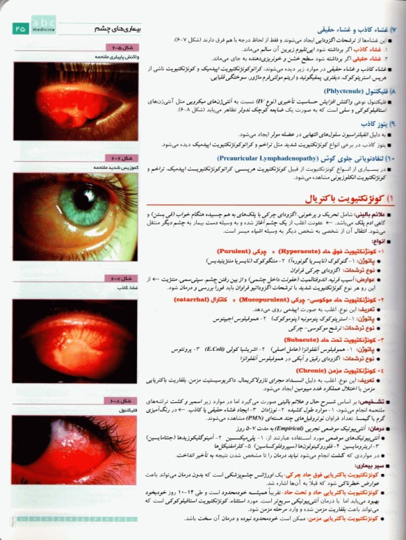 آسان آموز پزشکی abc medicine درس آزمون بیماری‌های چشم