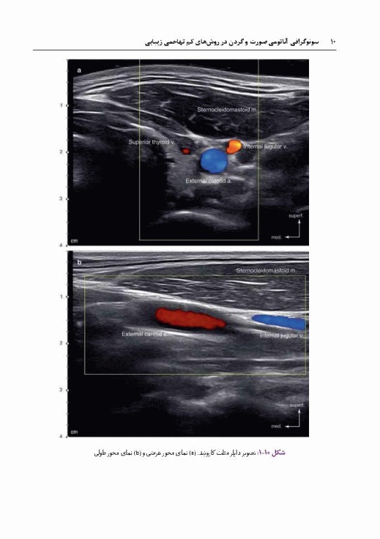 سونوگرافی آناتومی صورت و گردن در روش‌های کم تهاجمی زیبایی