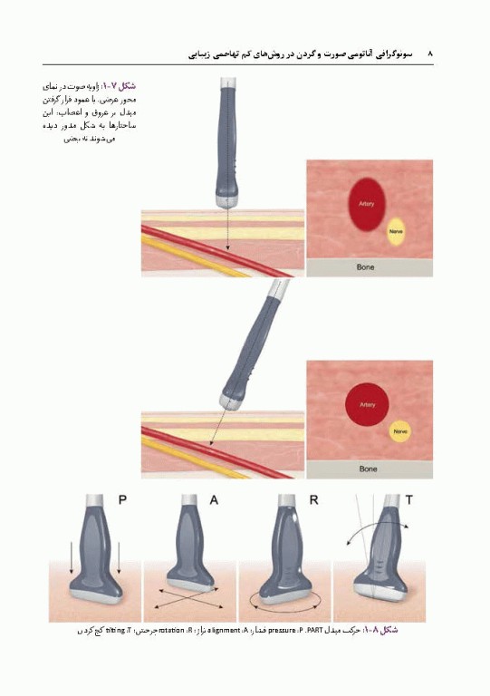 سونوگرافی آناتومی صورت و گردن در روش‌های کم تهاجمی زیبایی