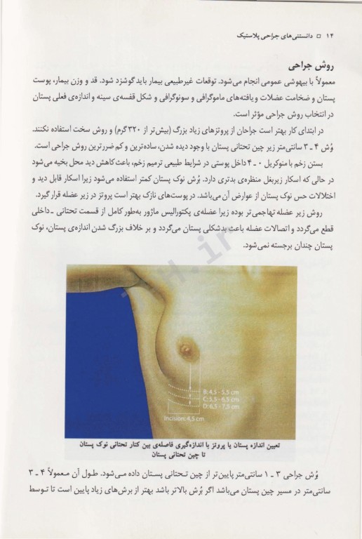 دانستنی‌های جراحی پلاستیک