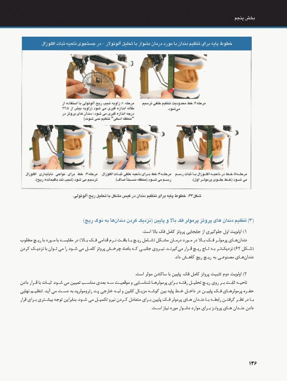 ساکشن پروتز کامل فک پایین بصورت پیشرفته