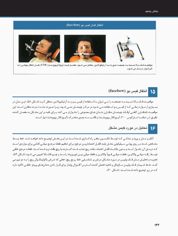 ساکشن پروتز کامل فک پایین بصورت پیشرفته