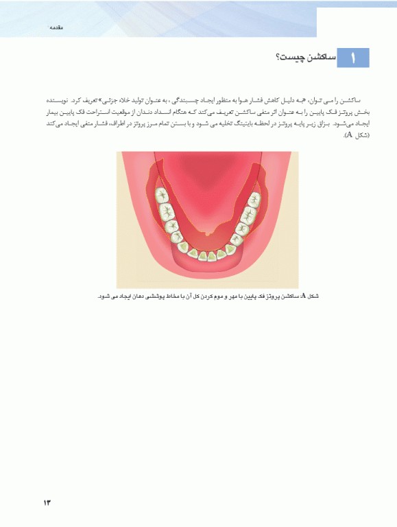همه می‌توانند به پروتز کامل فک پایین با ساکشن دست یابند SEMCD