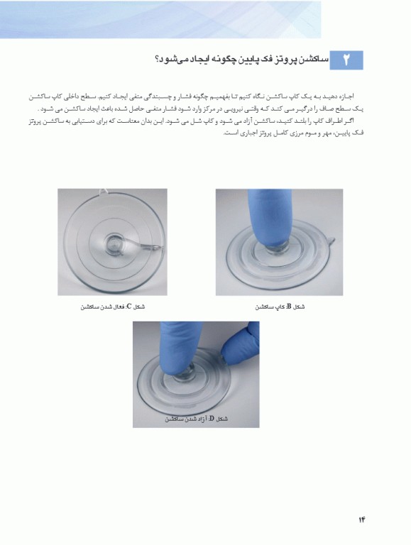 همه می‌توانند به پروتز کامل فک پایین با ساکشن دست یابند SEMCD