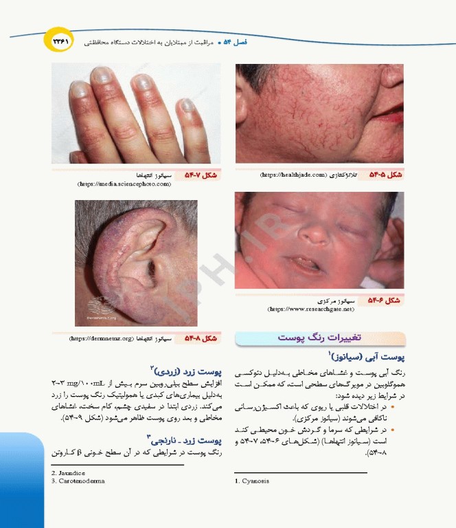 درسنامه‌ی پرستاری داخلی جراحی بزرگسالان و سالمندان جلد4