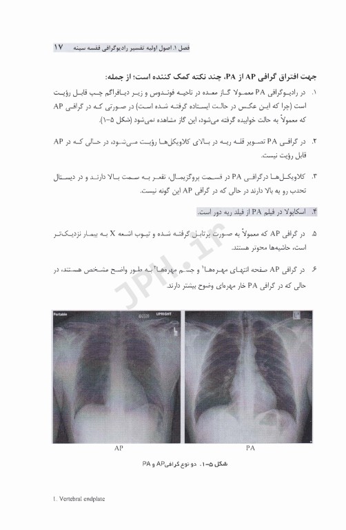 نقش رادیوگرافی قفسه سینه در تشخیص بیماری‌های قلب و عروق