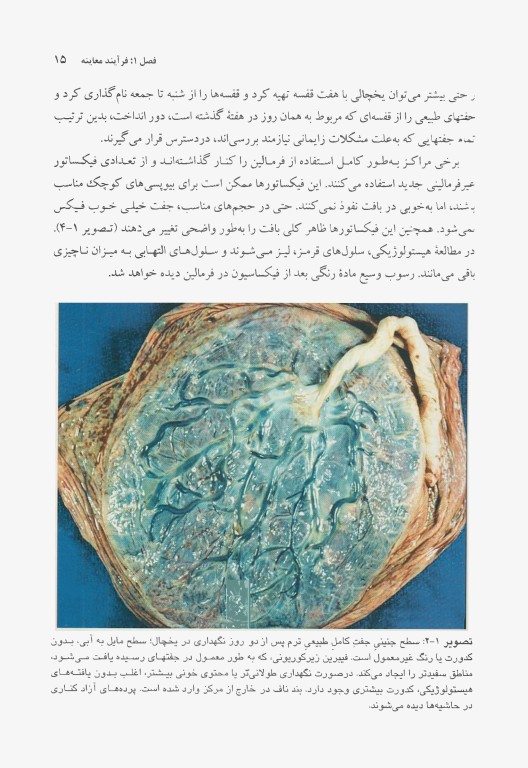 اطلس رنگی جفت و پرده‌های جنینی