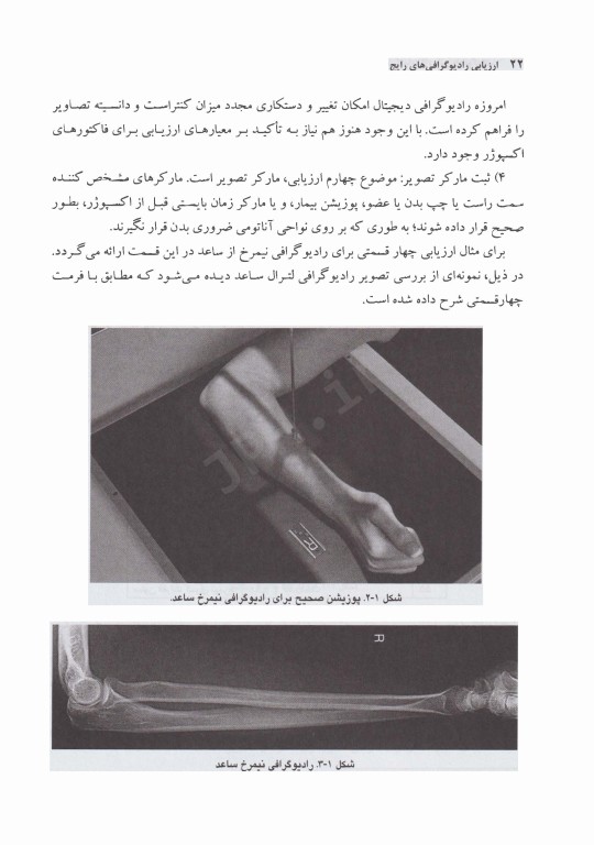 ارزیابی رادیوگرافی‌های رایج