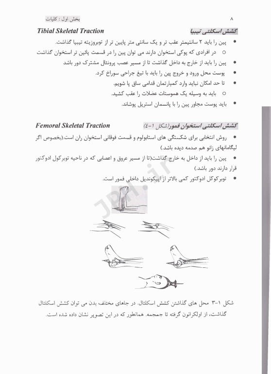 اصول شکستگی، در رفتگی‌ها (دوجلدی)