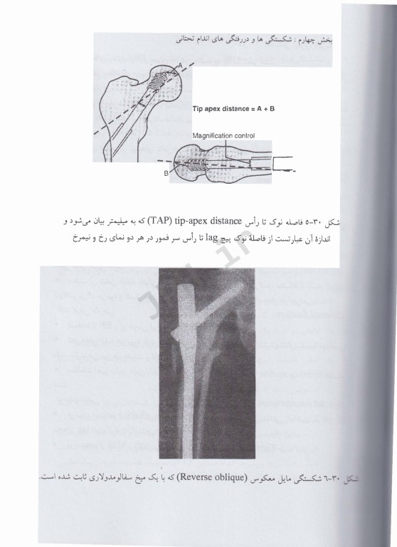 اصول شکستگی، در رفتگی‌ها (دوجلدی)