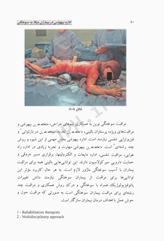 اداره بیهوشی در بیماران مبتلا به سوختگی