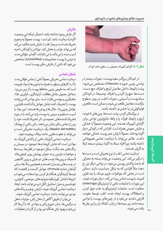 مدیریت علائم بیماری‌های شایع در داروسازی 2023