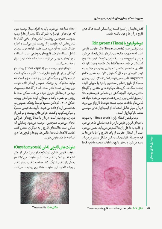 مدیریت علائم بیماری‌های شایع در داروسازی 2023