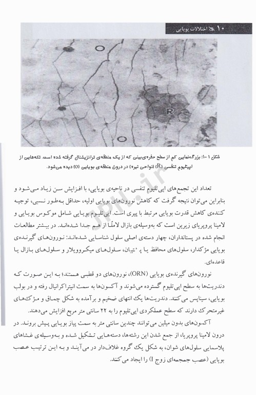 اختلالات بویایی