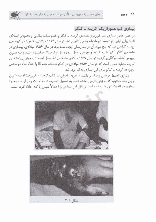 تب‌های هموراژیک ویروسی