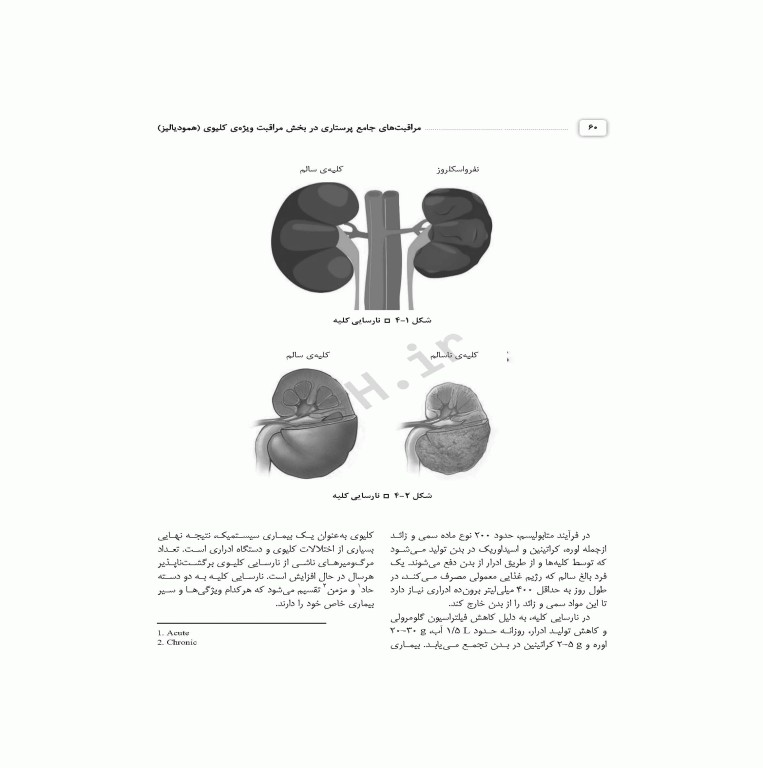 مراقبت‌های جامع پرستاری در بخش مراقبت ویژه کلیوی همودیالیز