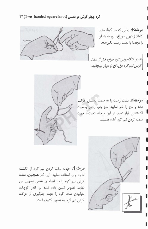 گره‌های جراحی و تکنیک‌های بخیه