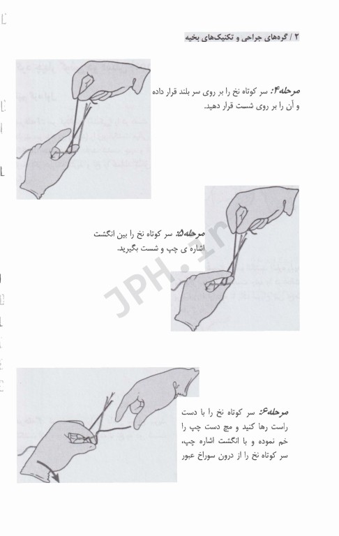 گره‌های جراحی و تکنیک‌های بخیه