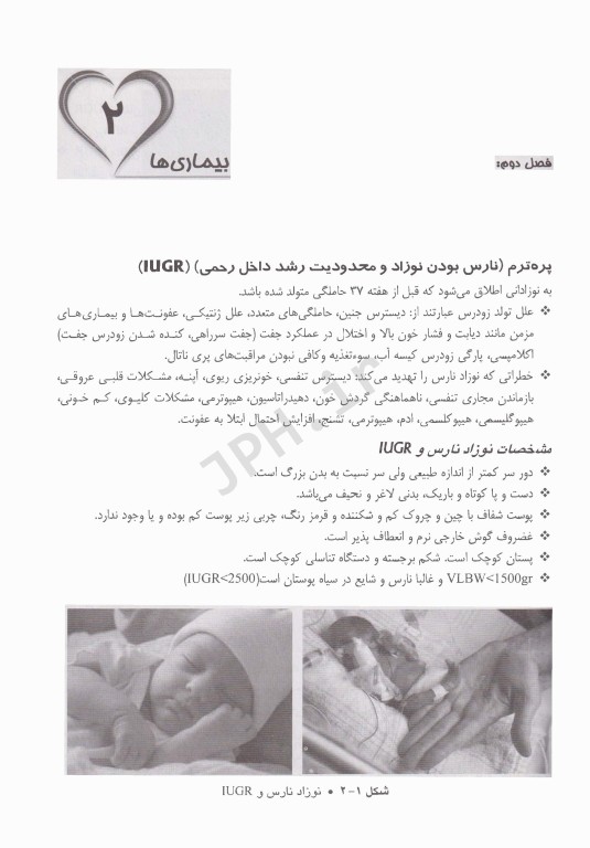 پرستاری در بخش مراقبت‌های ویژه نوزادان NICU