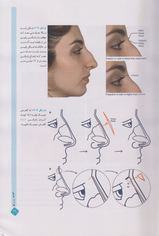 اطلس تصویربرداری در جراحی بینی