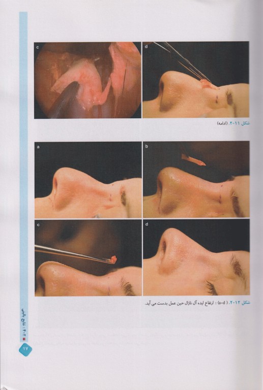 اطلس تصویربرداری در جراحی بینی