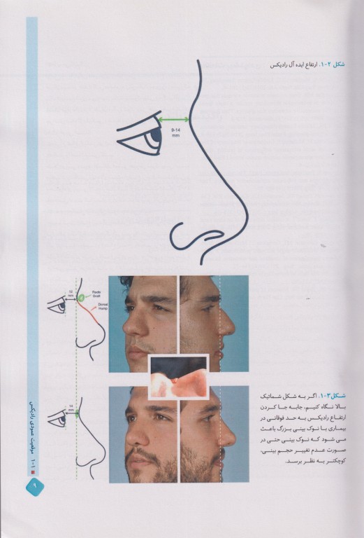 اطلس تصویربرداری در جراحی بینی