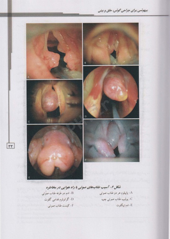 بیهوشی در جراحی‌های گوش، حلق و بینی