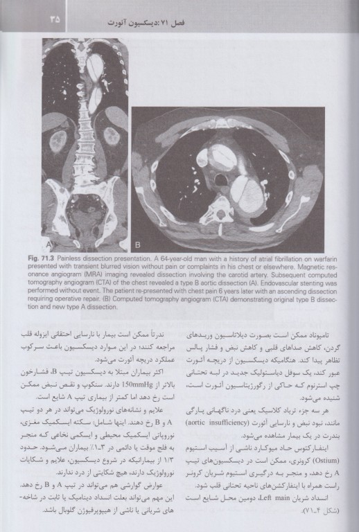 مجموعه ترجمه و تلخیص دانشنامه طب اورژانس روزن 2022 بیماری‌های عروق