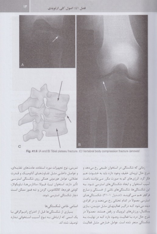 مجموعه ترجمه و تلخیص دانشنامه طب اورژانس روزن 2022 ارتوپدی