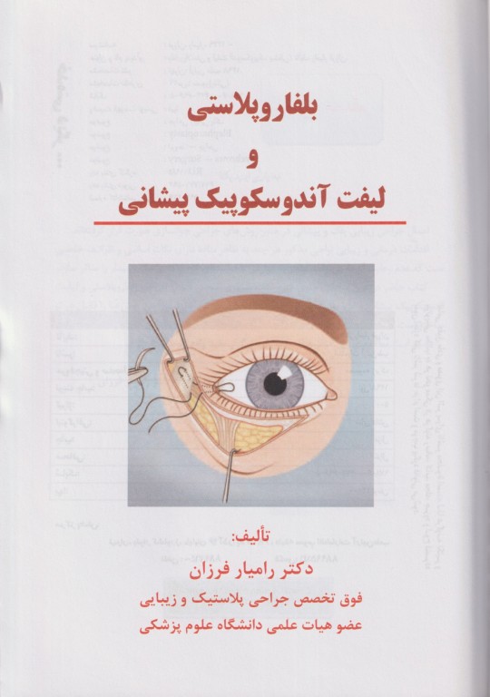 بلفاروپلاستی و لیفت آندوسکوپیک پیشانی