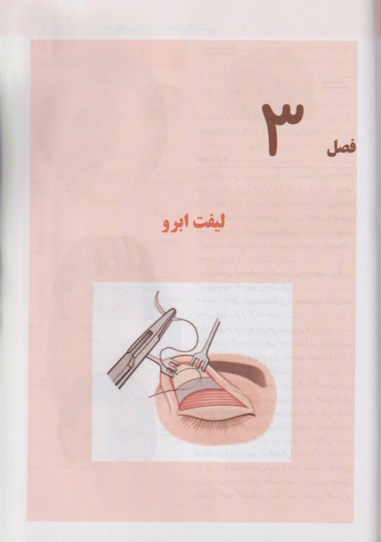 بلفاروپلاستی و لیفت آندوسکوپیک پیشانی