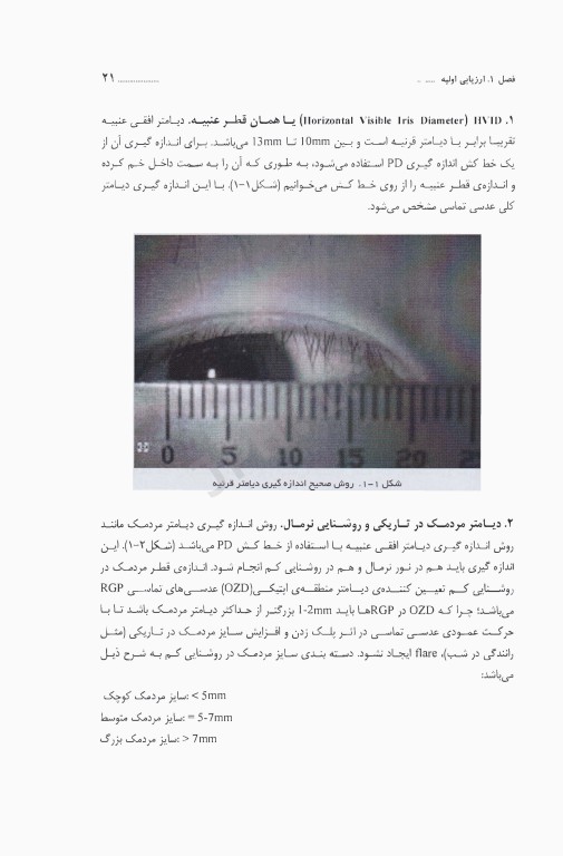 راهنمای کلینیکی عدسی‌های تماسی