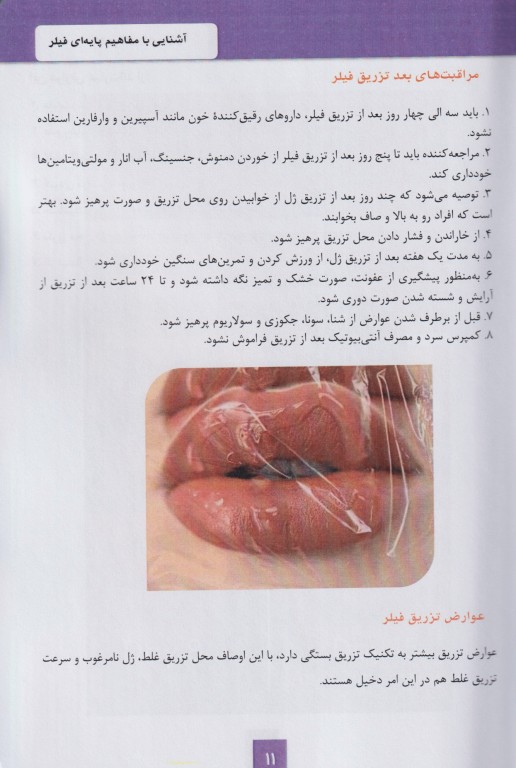 مفاهیم کاربردی فیلر صورت