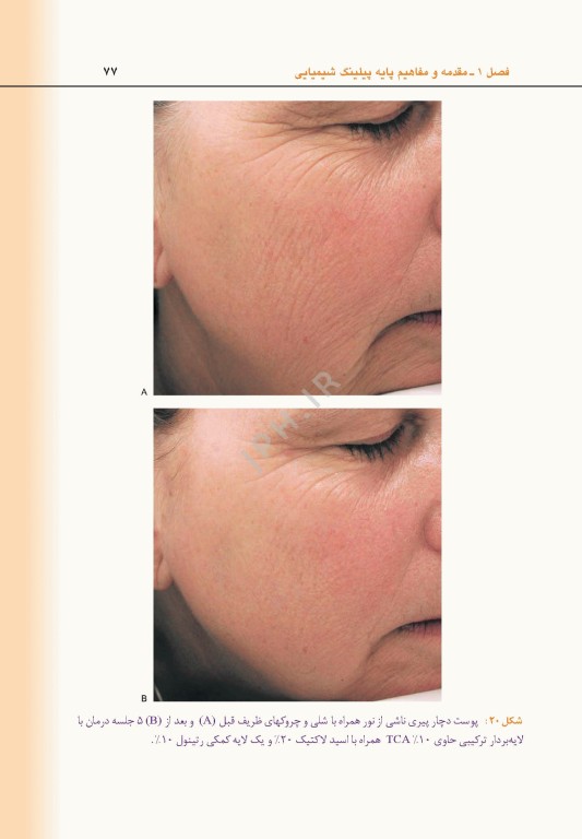 راهنمای کاربردی لایه برداری زیبایی و جوانسازی دارویی پوست دکتر داوود رمزی