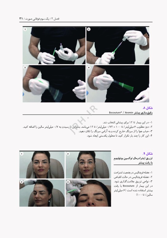 توکسین بوتولینوم در طب زیبایی، پروتکل های تزریق و درمان عوارض