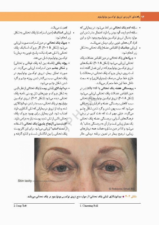 راهنمای کاربردی تزریق توکسین بوتولینوم دکتر رمزی