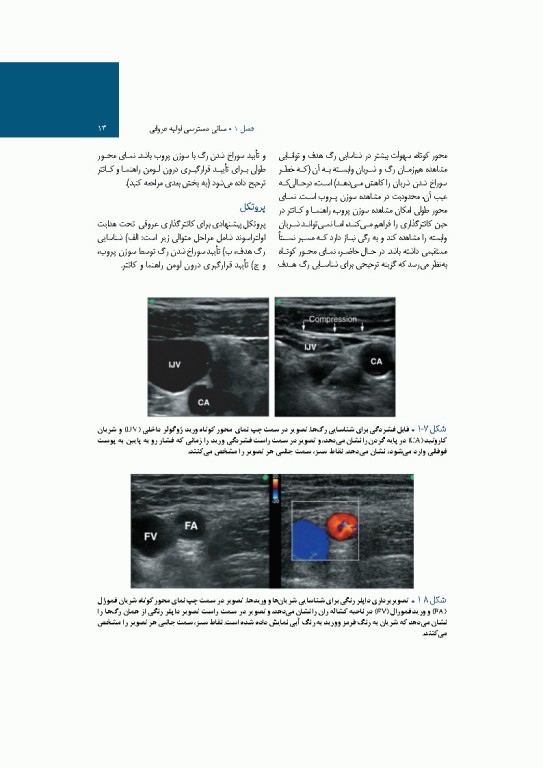 کتاب کامل ICU پل مارینو 2025