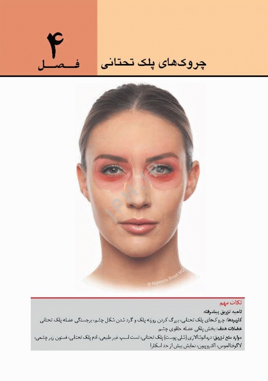 راهنمای کاربردی تزریق توکسین بوتولینوم دکتر رمزی