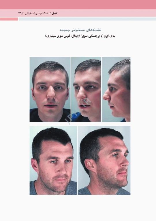 آناتومی حالات چهره بر اساس حرکات و بیان عواطف