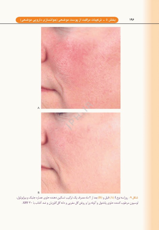 راهنمای کاربردی لایه برداری زیبایی و جوانسازی دارویی پوست دکتر داوود رمزی