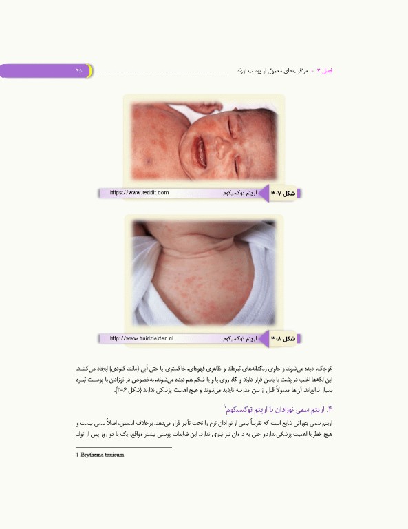 مراقبت‌های روتین نوزادان و شیرخواران کلینیک نوزادان در منزل شما