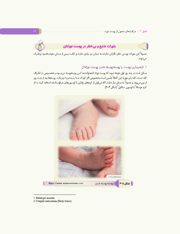 مراقبت‌های روتین نوزادان و شیرخواران کلینیک نوزادان در منزل شما